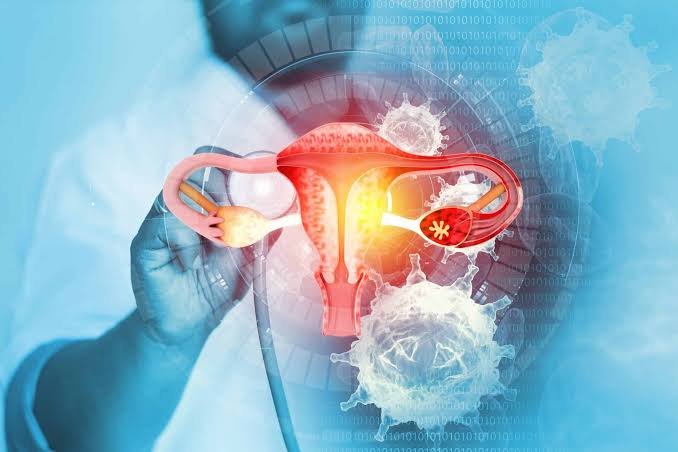 DOS CIENTÍFICOS COLOMBIANOS IMPULSAN UNA NUEVA FORMA DE REALIZAR EN CASA EL TAMIZAJE DEL CÁNCER DE CUELLO UTERINO